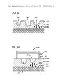 DEVICES AND METHODS FOR PERFORMING SUBCUTANEOUS SURGERY diagram and image