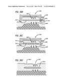 DEVICES AND METHODS FOR PERFORMING SUBCUTANEOUS SURGERY diagram and image