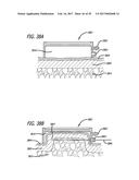 DEVICES AND METHODS FOR PERFORMING SUBCUTANEOUS SURGERY diagram and image