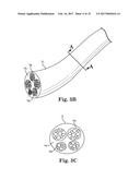 PRECISION ELECTRODE MOVEMENT CONTROL FOR RENAL NERVE ABLATION diagram and image