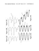 PRECISION ELECTRODE MOVEMENT CONTROL FOR RENAL NERVE ABLATION diagram and image