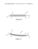 PRECISION ELECTRODE MOVEMENT CONTROL FOR RENAL NERVE ABLATION diagram and image