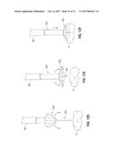 MICROWAVE ANTENNA PROBE HAVING A DEPLOYABLE GROUND PLANE diagram and image