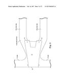 TISSUE ANCHOR AND A SUTURE INSERTED THROUGH THE TISSUE ANCHOR HAVING END     PORTIONS OF THE SUTURE MAINTAINED WITHIN A CONDUIT diagram and image