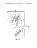 TISSUE ANCHOR AND A SUTURE INSERTED THROUGH THE TISSUE ANCHOR HAVING END     PORTIONS OF THE SUTURE MAINTAINED WITHIN A CONDUIT diagram and image