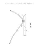 TISSUE ANCHOR AND A SUTURE INSERTED THROUGH THE TISSUE ANCHOR HAVING END     PORTIONS OF THE SUTURE MAINTAINED WITHIN A CONDUIT diagram and image