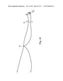 TISSUE ANCHOR AND A SUTURE INSERTED THROUGH THE TISSUE ANCHOR HAVING END     PORTIONS OF THE SUTURE MAINTAINED WITHIN A CONDUIT diagram and image