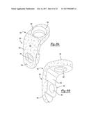 MODULAR LATERAL HIP AUGMENTS diagram and image