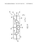 EXPANDABLE IMPLANT diagram and image