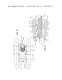 EXPANDABLE SPINAL IMPLANT AND METHOD OF IMPLANTING SAME diagram and image