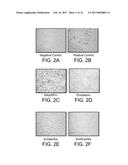 USE OF UNDARIA EXTRACT TO REDUCE SIGNS OF SKIN AGING diagram and image