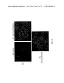 TREATMENT OF COMPLEMENT-ASSOCIATED DISORDERS diagram and image