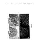 TREATMENT OF COMPLEMENT-ASSOCIATED DISORDERS diagram and image