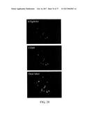 TREATMENT OF COMPLEMENT-ASSOCIATED DISORDERS diagram and image