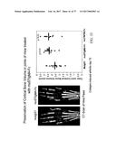 TREATMENT OF COMPLEMENT-ASSOCIATED DISORDERS diagram and image