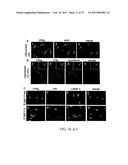 TREATMENT OF COMPLEMENT-ASSOCIATED DISORDERS diagram and image