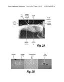 CNS DELIVERY OF THERAPEUTIC AGENTS diagram and image