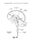 CNS DELIVERY OF THERAPEUTIC AGENTS diagram and image