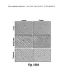 CNS DELIVERY OF THERAPEUTIC AGENTS diagram and image