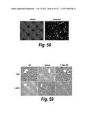 CNS DELIVERY OF THERAPEUTIC AGENTS diagram and image