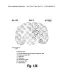 CNS DELIVERY OF THERAPEUTIC AGENTS diagram and image