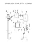 Steerable Aspiration Catheter System diagram and image