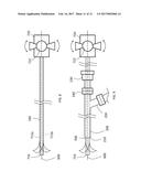 Steerable Aspiration Catheter System diagram and image