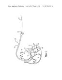 LEAD DELIVERY DEVICE AND METHOD diagram and image