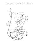 LEAD DELIVERY DEVICE AND METHOD diagram and image