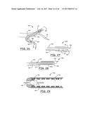 LEAD DELIVERY DEVICE AND METHOD diagram and image