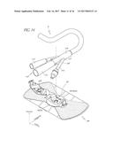 Anchoring System For A Medical Article diagram and image