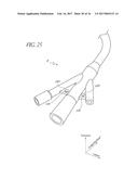 Anchoring System For A Medical Article diagram and image