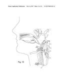 HEAD PAIN MANAGEMENT DEVICE HAVING AN ANTENNA diagram and image