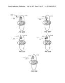 IMAGING ASSISTED INTEGRATED TOMOGRAPHY - CANCER TREATMENT APPARATUS AND     METHOD OF USE THEREOF diagram and image