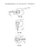 IMAGING ASSISTED INTEGRATED TOMOGRAPHY - CANCER TREATMENT APPARATUS AND     METHOD OF USE THEREOF diagram and image