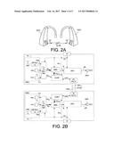BINAURAL HEARING ASSISTANCE SYSTEM COMPRISING BINAURAL NOISE REDUCTION diagram and image