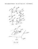 BED SHEET LIFT SYSTEM diagram and image