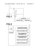 RADIOGRAPHIC IMAGE PROCESSING APPARATUS AND METHOD AND RECORDING MEDIUM     STORING THEREIN RADIOGRAPHIC IMAGE PROCESSING PROGRAM diagram and image