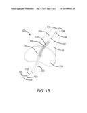 DEVICES AND SYSTEMS FOR INVERTING AND CLOSING THE LEFT ATRIAL APPENDAGE diagram and image