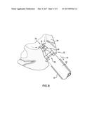 Apical Closure System diagram and image