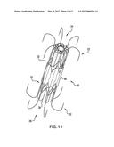 Apical Closure System diagram and image