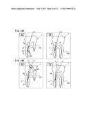 ROOT CANAL TREATING DISPLAY DEVICE, ROOT CANAL TREATING UNIT, AND DENTAL     IMAGE DISPLAY METHOD diagram and image