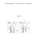 ROOT CANAL TREATING DISPLAY DEVICE, ROOT CANAL TREATING UNIT, AND DENTAL     IMAGE DISPLAY METHOD diagram and image