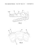 ORTHODONTIC APPLIANCES CONFIGURED TO RECEIVE AND TRANSMIT BIOLOGIC     STIMULATION diagram and image