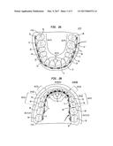 Bracket System diagram and image