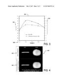 NEGATIVE RESISTANCE PREAMPLIFIER FOR INDUCTIVELY COUPLED LOCAL MRI COILS diagram and image