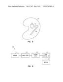 ANTENNAS FOR HEARING AIDS diagram and image