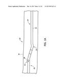 TISSUE-REMOVING CATHETER WITH ASYMMETRIC WINDOW diagram and image