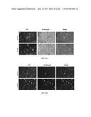 METHODS AND COMPOSITIONS FOR THE TREATMENT OF GLAUCOMA diagram and image