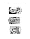 Platelet-Derived Growth Factor Compositions and Methods of Use Thereof diagram and image